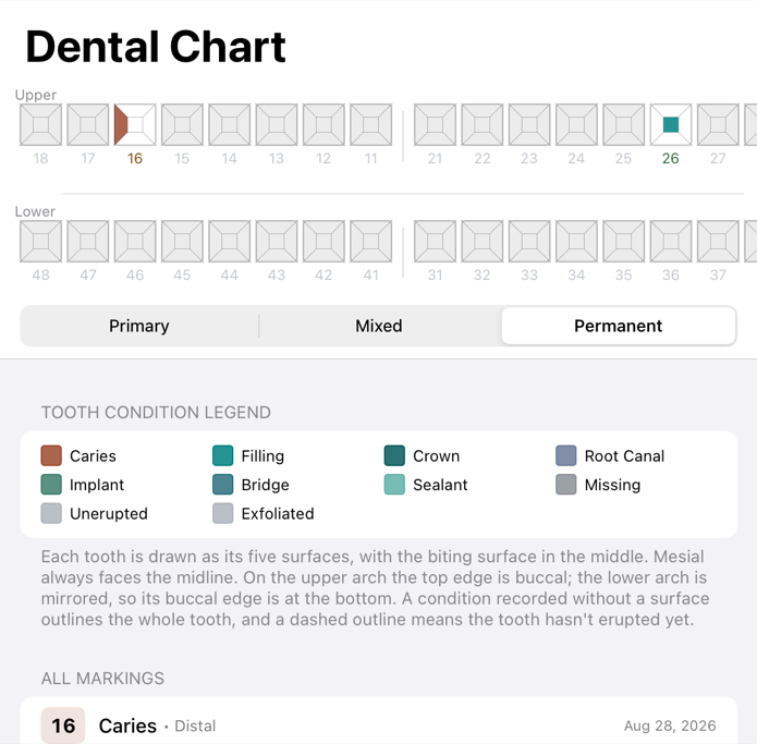 The dental chart: two arches of teeth, each drawn as five surfaces, with a caries marking on tooth 16 and a filling on 26, above the dentition picker, the condition legend and the list of markings.